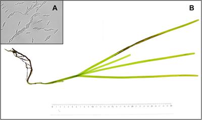 Complex Interactions of Temperature, Light and Tissue Damage on Seagrass Wasting Disease in Zostera marina